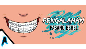 Pengalaman Pasang Behel! 8 Pengalaman Pasang Behel - Ahasna